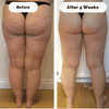DERMALIFT – Hautstraffendes Gerät Gegen Cellulite