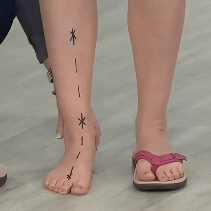 Pylomo Sandals - Orthopedic Summer Sandals for Pain Relief and Posture Improvement