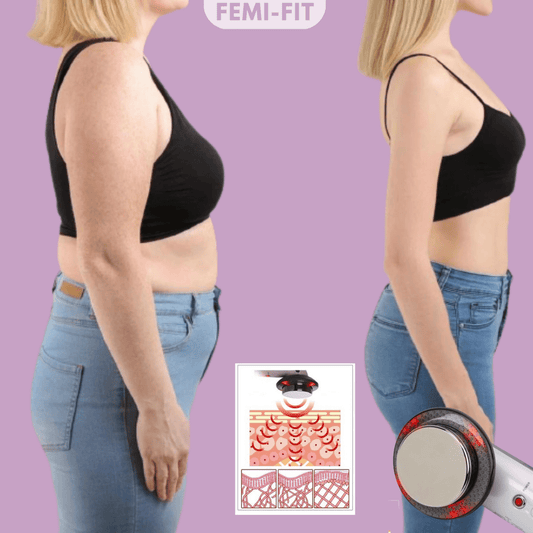 SchlankForm – 3-In-1 Cellulite- & Fettbrenner Mit EMS, Ultraschall & Infrarotlicht