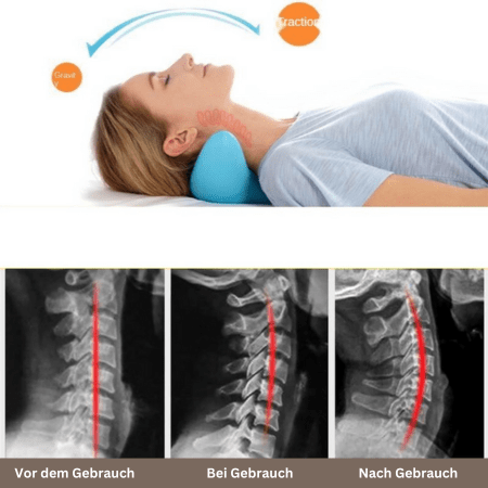 CerviRelax – Ergonomic Neck Massage Pillow For Relaxed Posture